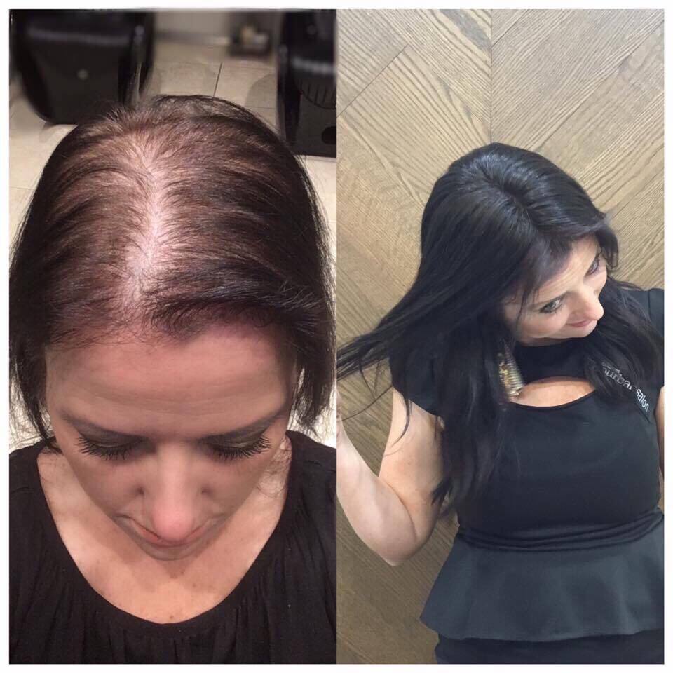 Amy | 100% Remy Hair Topper | Before and After