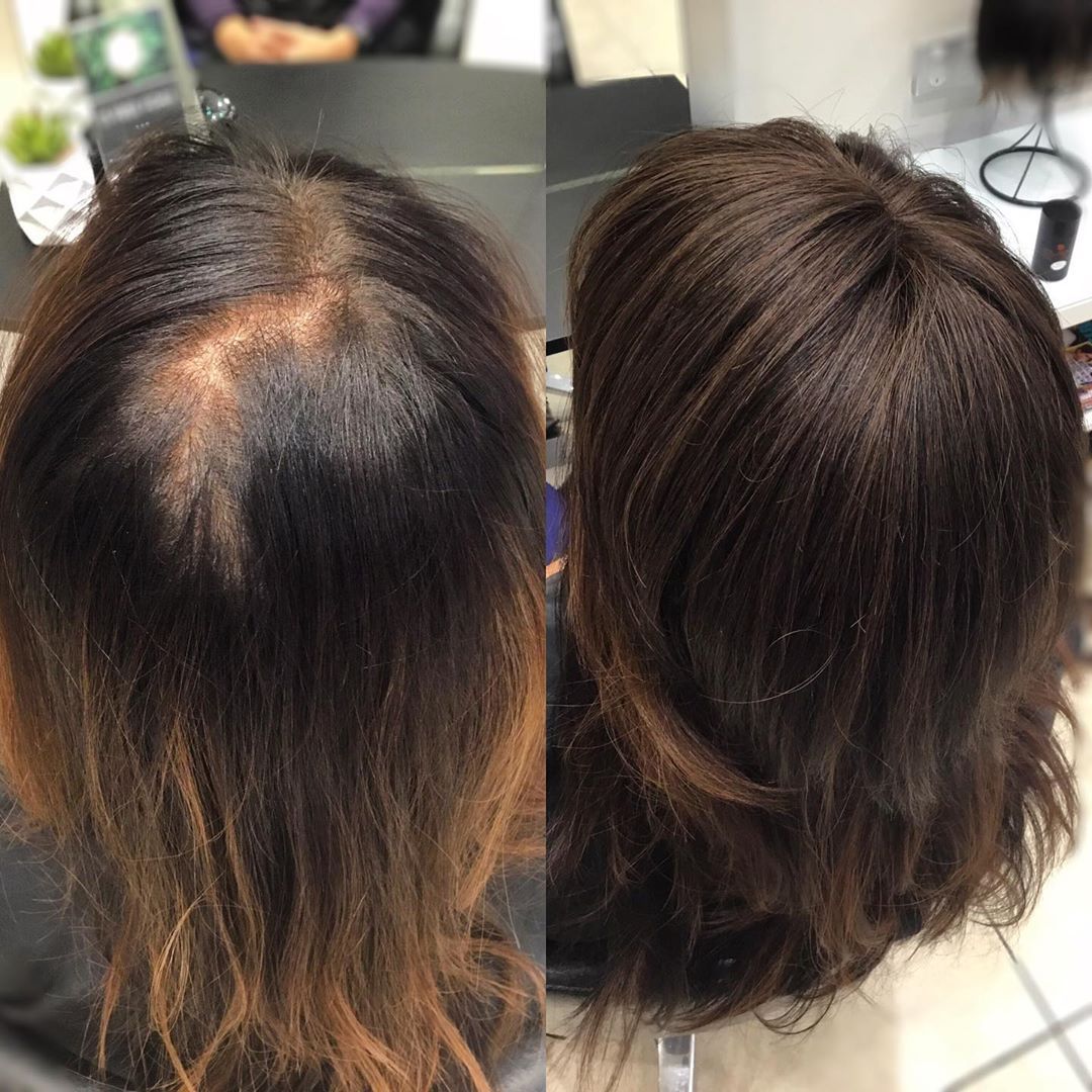 Marie | 100% Remy Hair Topper | Before and After