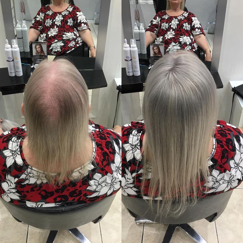 Monroe (Straight) | 100% Remy Hair Topper | Before and After