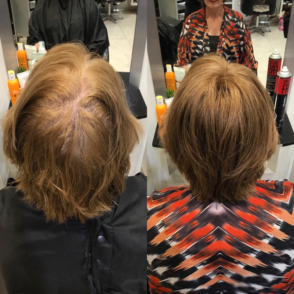 Karen | 100% Remy Hair Topper | Before and After