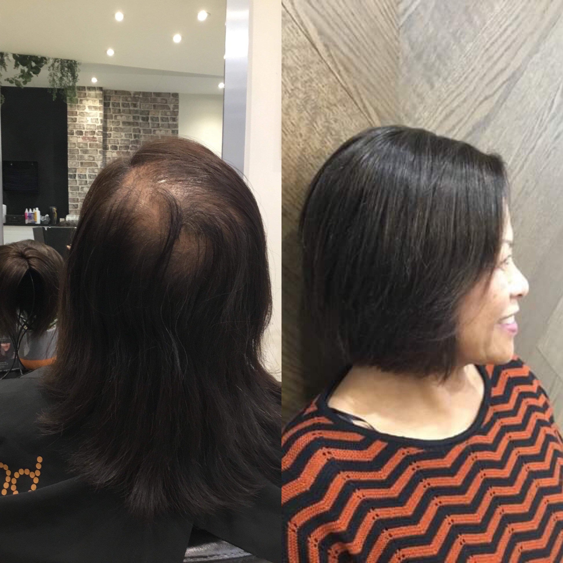 Marie (Silk Base) | 100% Remy Hair Topper | Before and After