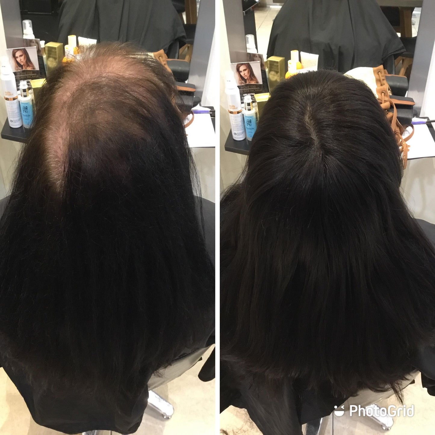Amy | 100% Remy Hair Topper | Before and After