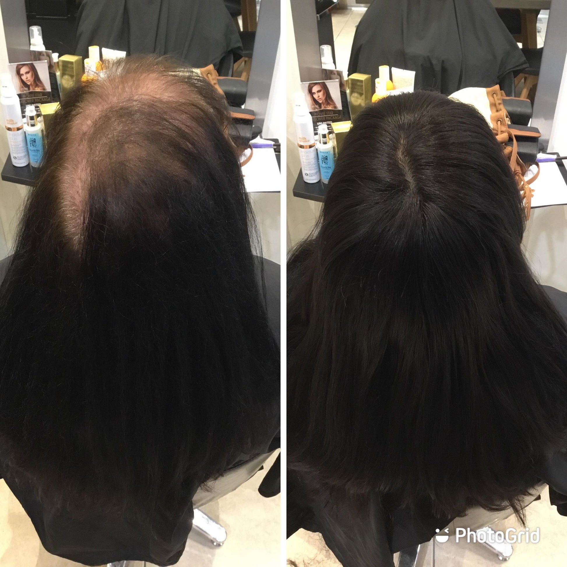 Amy | 100% Remy Hair Topper | Before and After
