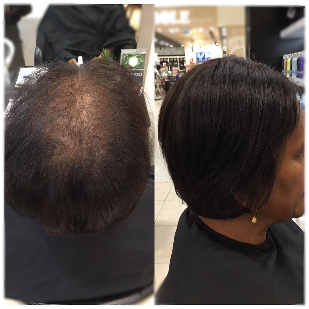 Amy | 100% Remy Hair Topper | Before and After
